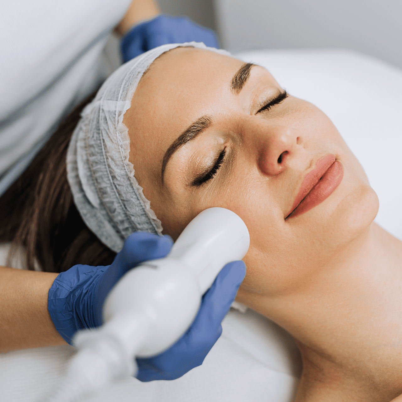microneedling microneedling